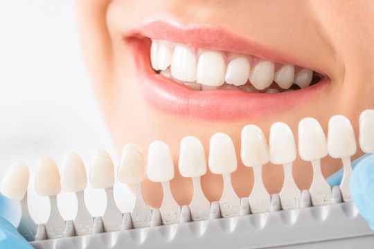 Estética – Lentes e Facetas de Porcelana