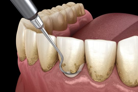 Periodontia