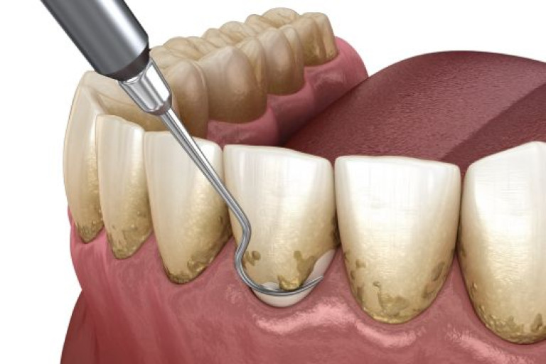 Periodontia